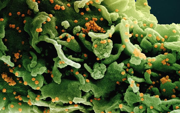 Article Image for Microbiome Research and Its Implications for Athletes